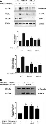 MYH9 Inhibition Suppresses TGF-β1-Stimulated Lung Fibroblast-to-Myofibroblast Differentiation